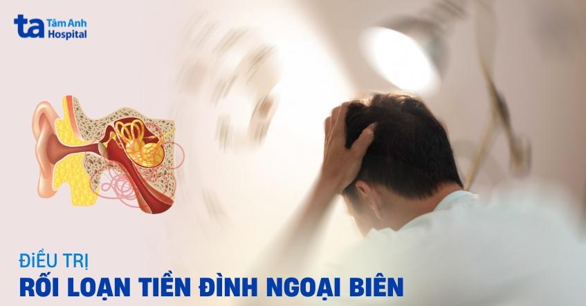 4 cách điều trị rối loạn tiền đình ngoại biên và phòng ngừa