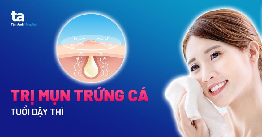 cách trị mụn trứng cá ở tuổi dậy thì