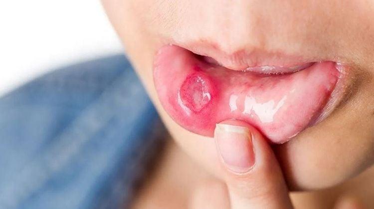 Công dụng và hướng dẫn dùng mật ong đúng cách