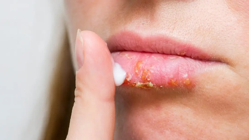 Cách dưỡng môi ban đêm cho đôi môi căng mọng, hồng hào