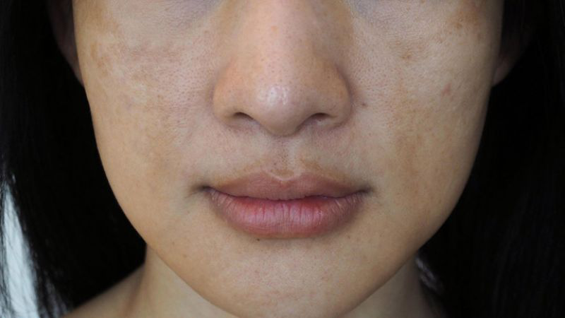 Alpha arbutin dùng sáng hay tối mang lại hiệu quả cao hơn? 1