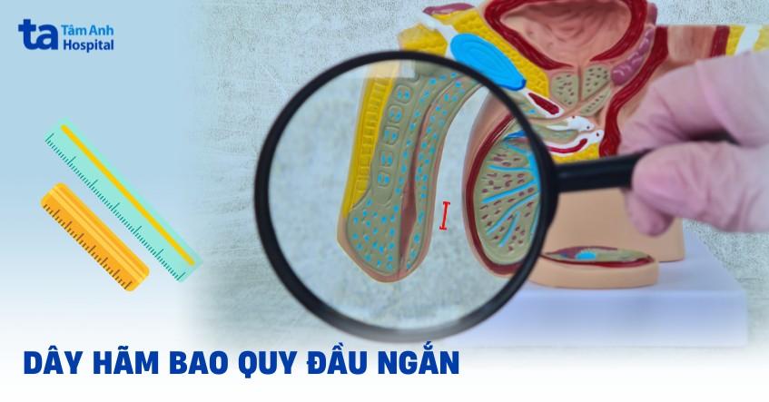 Dây hãm bao quy đầu ngắn phải làm sao? Nguyên nhân, triệu chứng