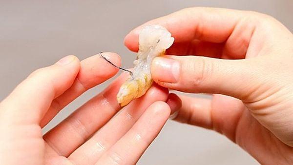 Gạch tôm có phải là phân của nó không? Sau đây là câu trả lời ấm lòng các tín đồ gạch tôm
