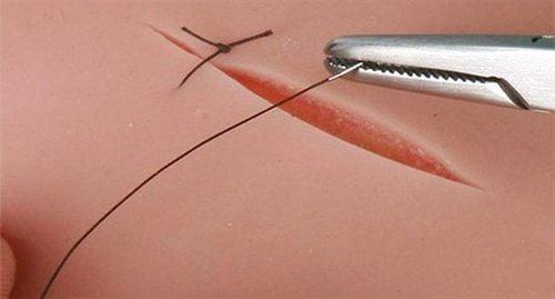 Chỉ tự tiêu là gì?