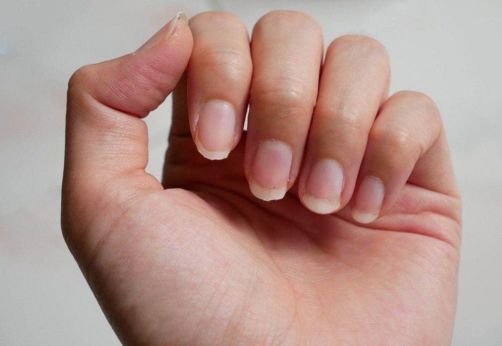 Móng tay nói gì về sức khỏe của bạn?