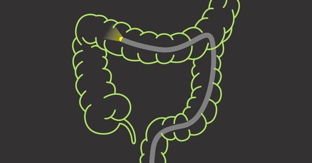 Ưu điểm của cắt polyp ống tiêu hóa qua nội soi tại Vinmec