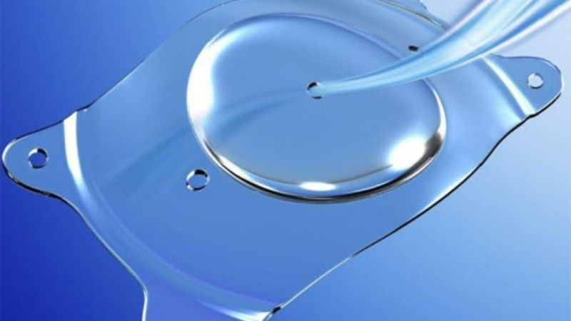 Phẫu thuật ICL là gì và quy trình thực hiện