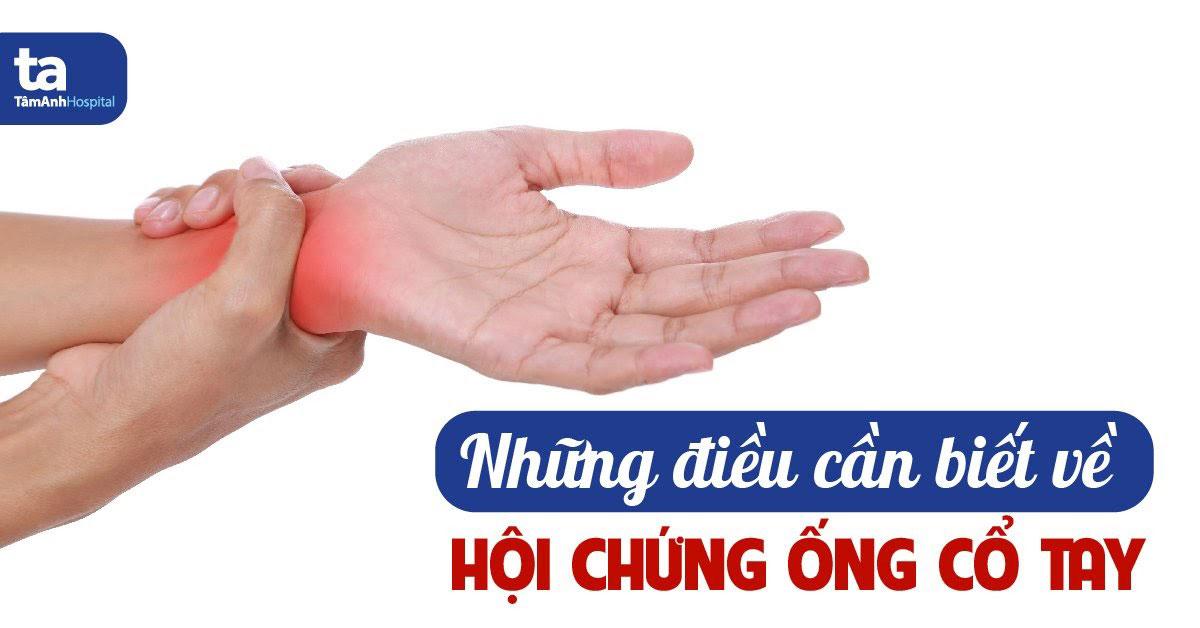 Hội chứng ống cổ tay: Nguyên nhân, triệu chứng và cách điều trị