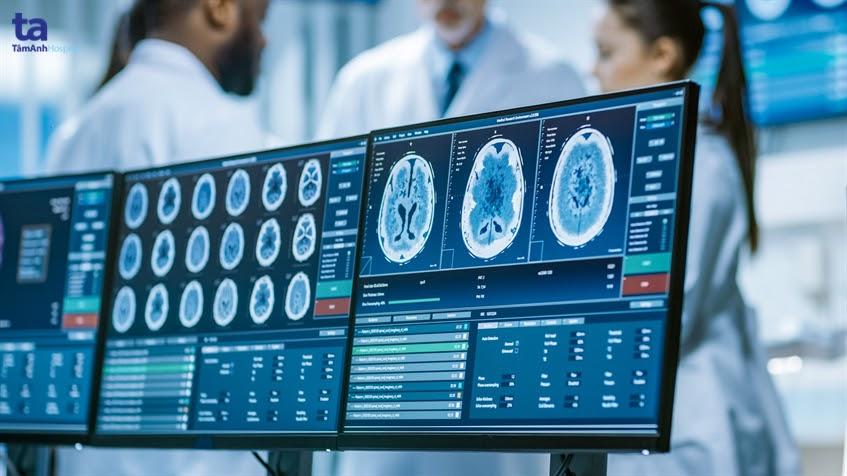 Chụp cắt lớp vi tính (chụp CT): Quy trình, ưu và nhược điểm