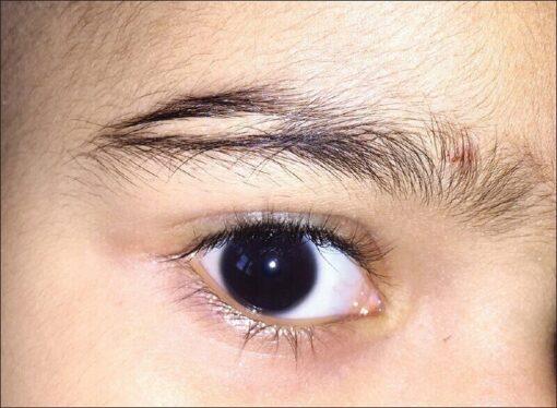 Lông mày đứt đoạn có ý nghĩa tốt hay xấu theo nhân tướng học