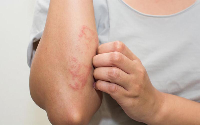 Cách vệ sinh vòi hoa sen sạch cặn bẩn trong tích tắc